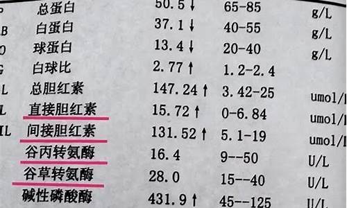 高考体检转氨酶高多少需要复查,高考体检转氨酶高